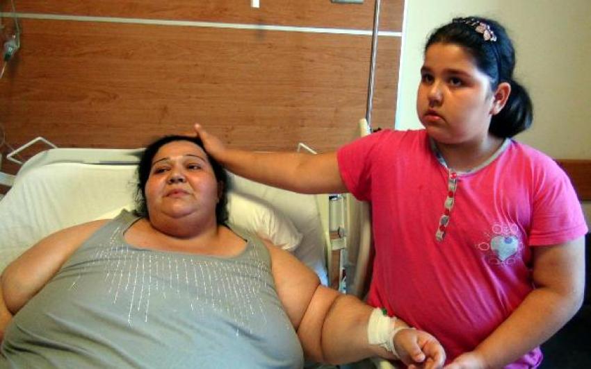 246 kiloluk kadının rahmi lazerle alındı