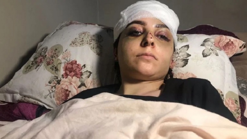 İstanbul’da ‘tayt’ şiddeti: Evli olduğu kadını öldüresiye dövdü!