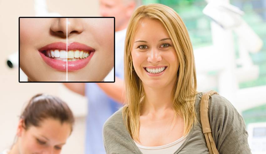 10 soruda diş beyazlatma