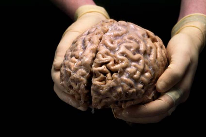 Parkinsonu insan beyni yiyerek yenin