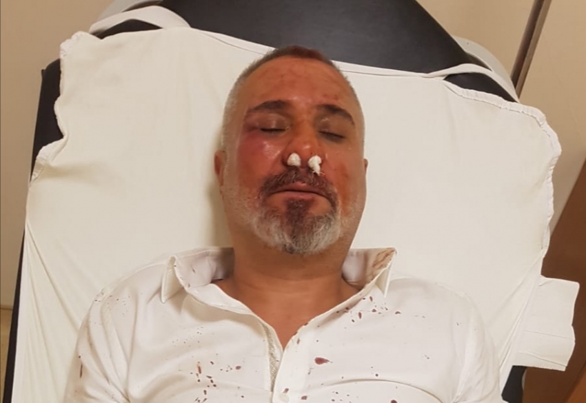 Bgc'den gazeteci Şaban Önen'e  saldırıya kınama