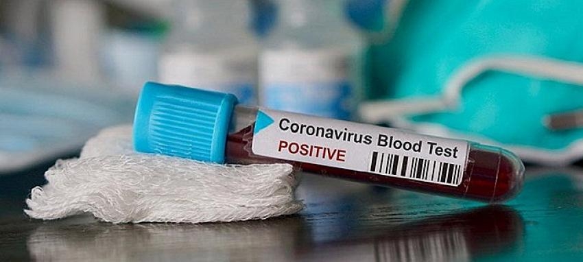 Koronavirüs salgınının faturası Çin'e kesildi! Trilyon dolarlık tazminat davası açılıyor