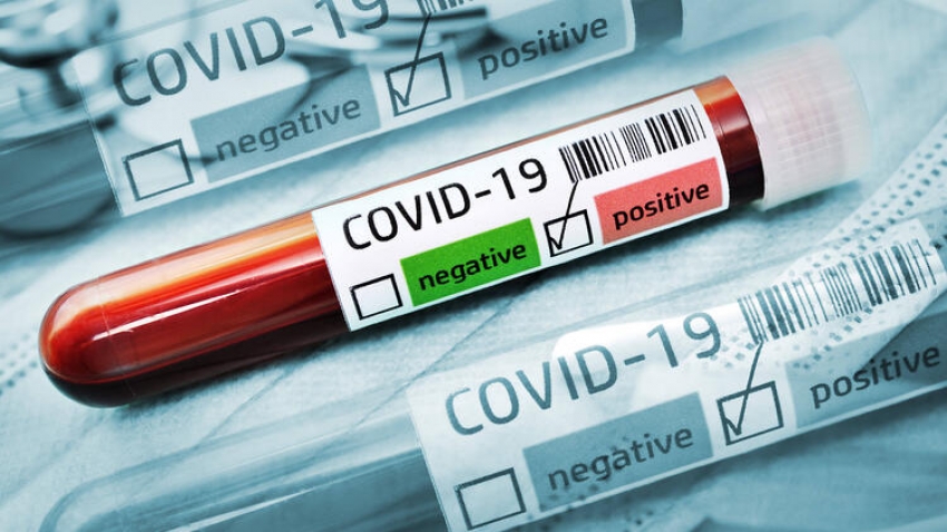  15 kişinin koronavirüs testlerinin pozitif çıktığını açıklandı